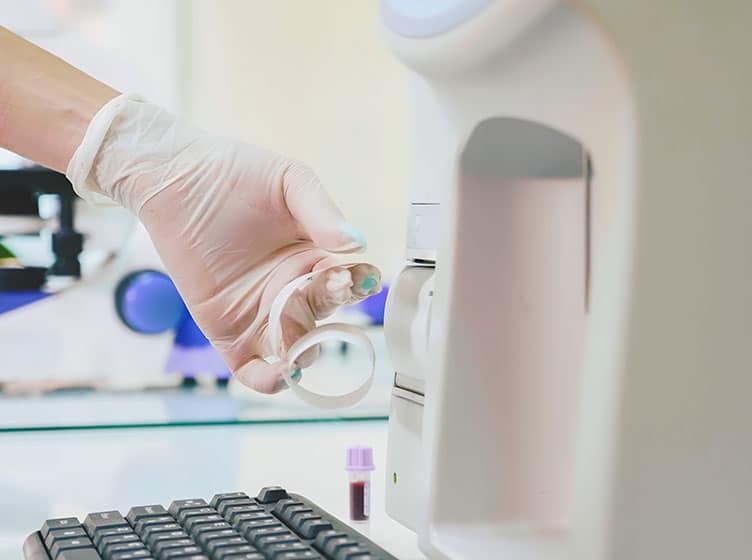 A gloved hand pulls a strip of paper from a medical laboratory machine near a keyboard, with a blood sample vial in the background—precise care you can expect from a mobile vet.